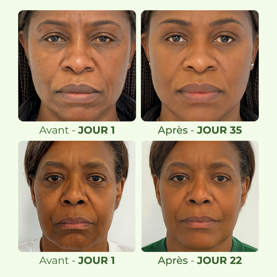 Masque Régénérant au Curcuma & Rétinol Radiance Los Angeles