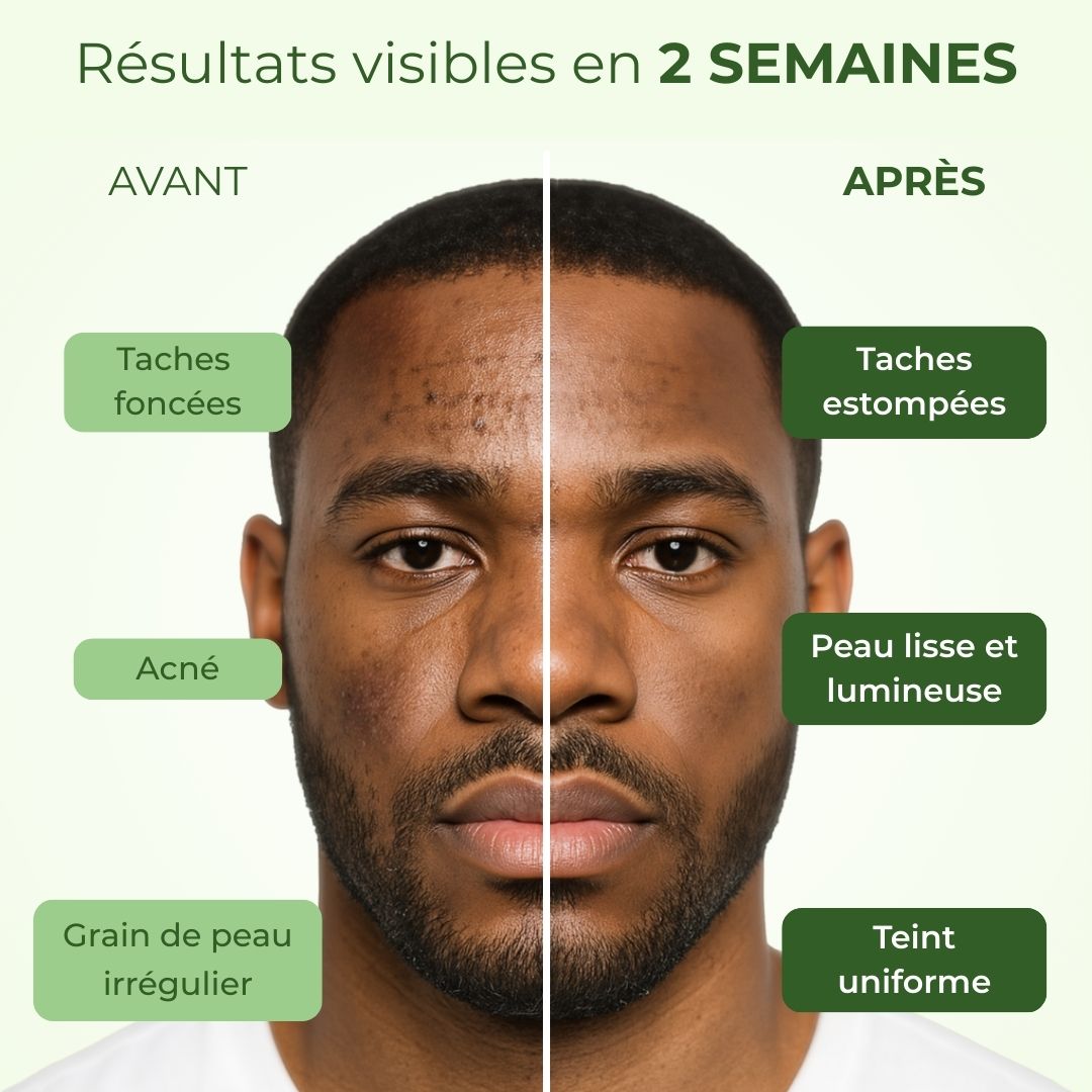 Savon Exfoliant au Curcuma Radiance Los Angeles