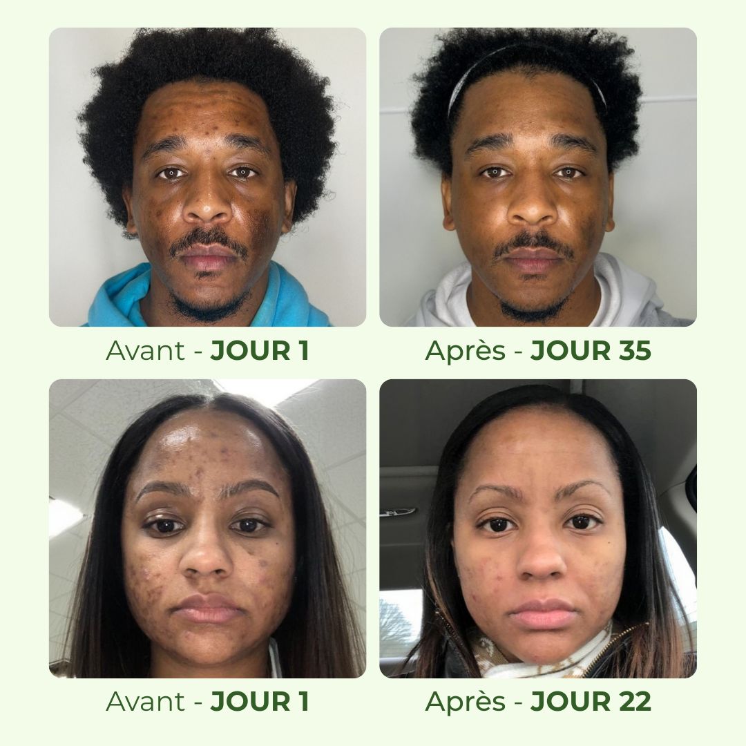 Savon Exfoliant au Curcuma Radiance Los Angeles