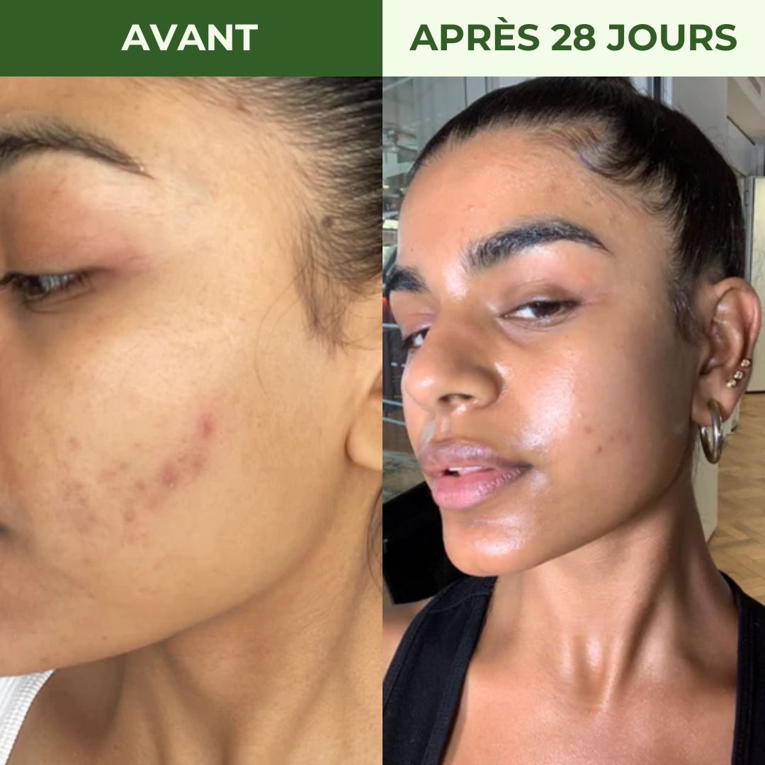 Nettoyant Visage au Curcuma Radiance Los Angeles