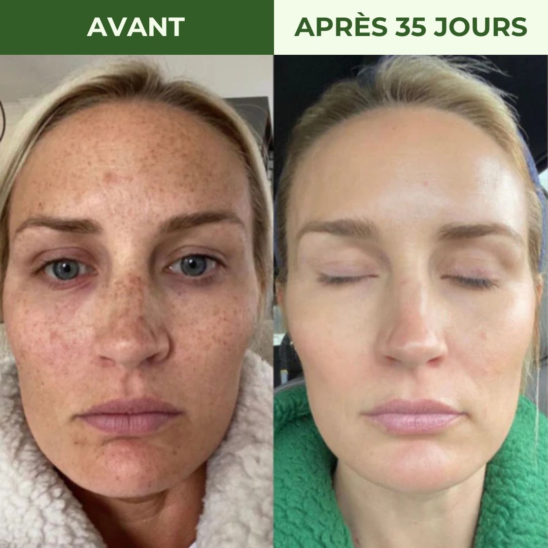 Nettoyant Visage au Curcuma Radiance Los Angeles